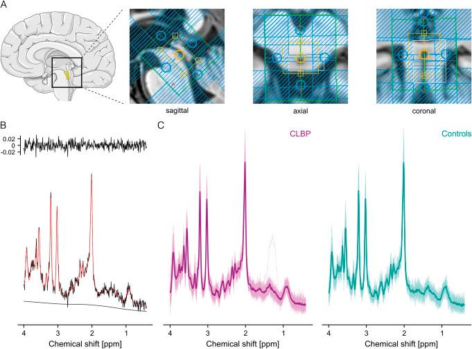 https://cdn.ncbi.nlm.nih.gov/pmc/blobs/c6e7/12168810/e2cddf106de3/jop-166-1690-g002.jpg