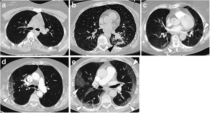 https://cdn.ncbi.nlm.nih.gov/pmc/blobs/c6e9/10792140/2e588eff2db9/13244_2023_1590_Fig3_HTML.jpg