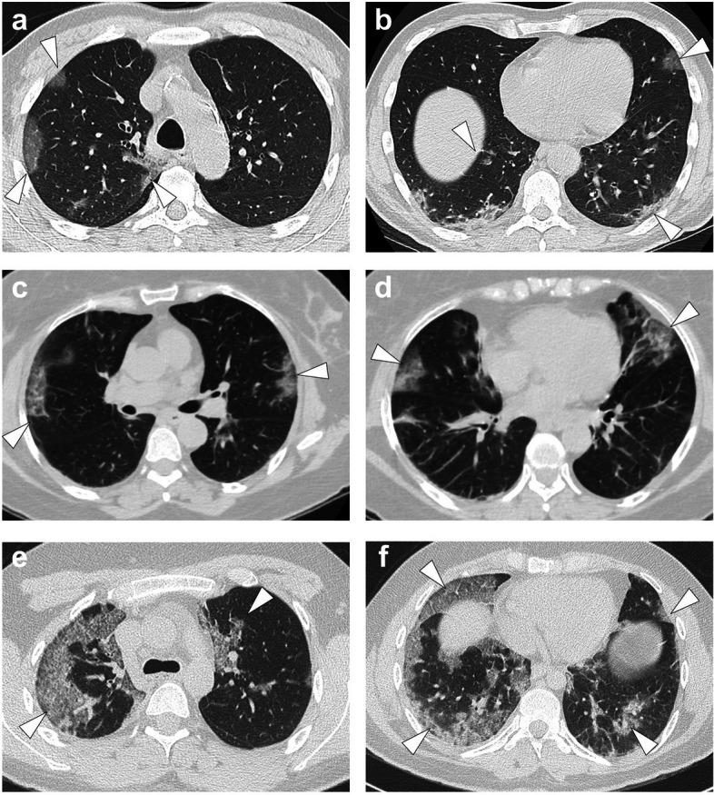 https://cdn.ncbi.nlm.nih.gov/pmc/blobs/c6e9/10792140/d02f66f3aac2/13244_2023_1590_Fig6_HTML.jpg