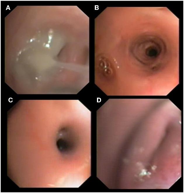 https://cdn.ncbi.nlm.nih.gov/pmc/blobs/c6e9/6783500/5ca25b5d84ee/fvets-06-00337-g0001.jpg