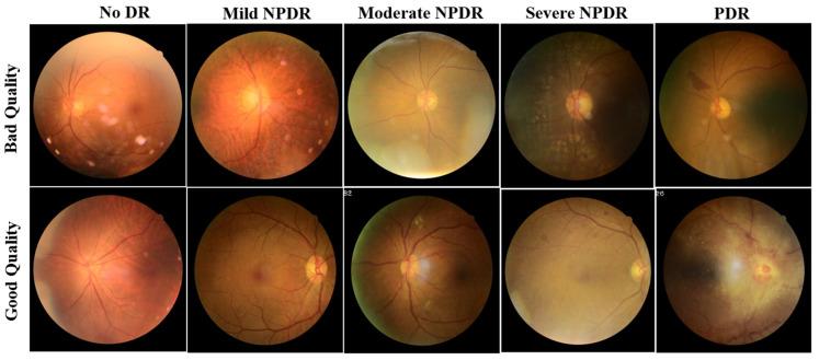 https://cdn.ncbi.nlm.nih.gov/pmc/blobs/c6e9/9955381/3660e90d4639/diagnostics-13-00622-g001.jpg