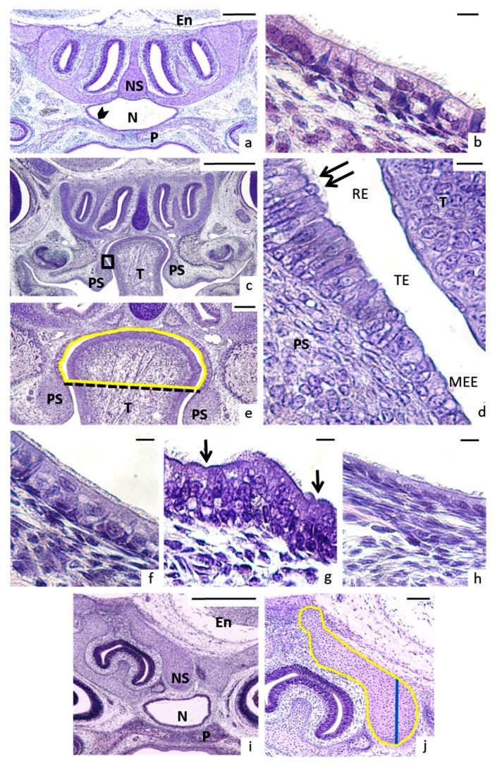 https://cdn.ncbi.nlm.nih.gov/pmc/blobs/c6eb/7830789/2c3bc17af4e2/nutrients-13-00251-g004.jpg
