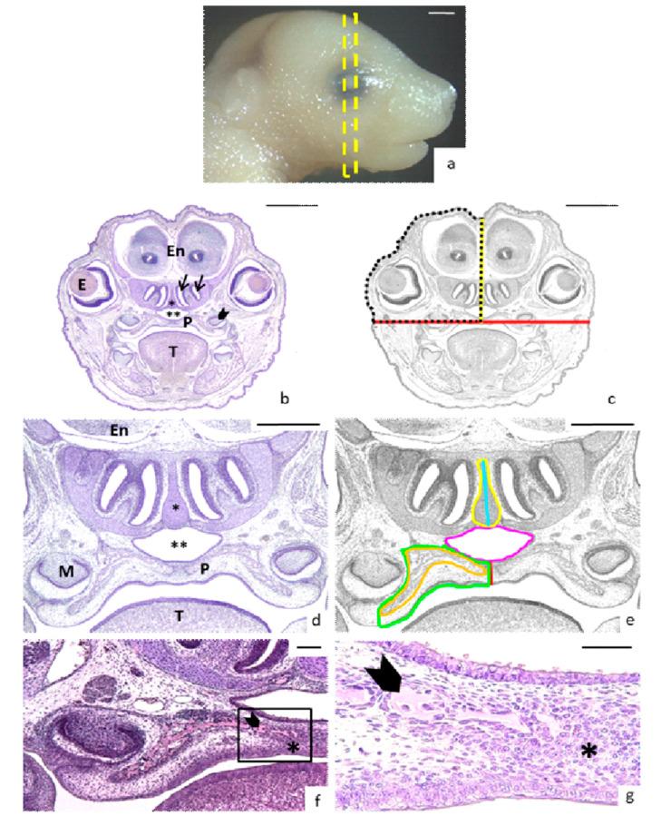 https://cdn.ncbi.nlm.nih.gov/pmc/blobs/c6eb/7830789/feb9b7ae8903/nutrients-13-00251-g001.jpg