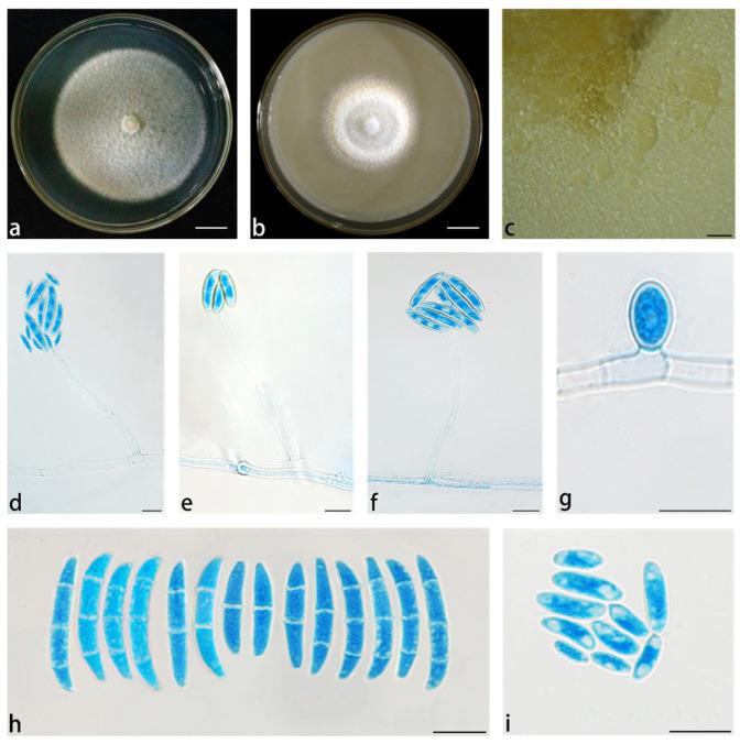 https://cdn.ncbi.nlm.nih.gov/pmc/blobs/c6ef/12387650/c2aad2cede4a/jof-11-00571-g006.jpg