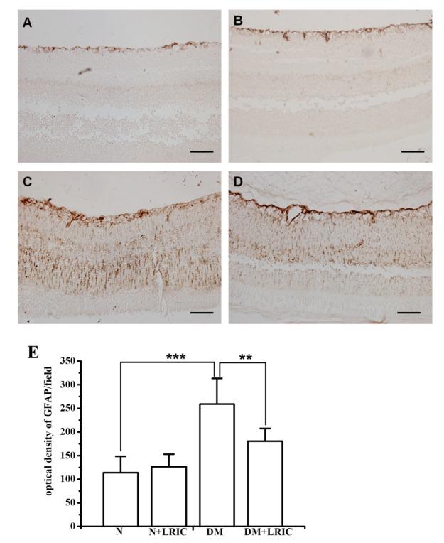 https://cdn.ncbi.nlm.nih.gov/pmc/blobs/c6f7/6284762/4d4957cc474b/ad-9-6-1122-g3.jpg