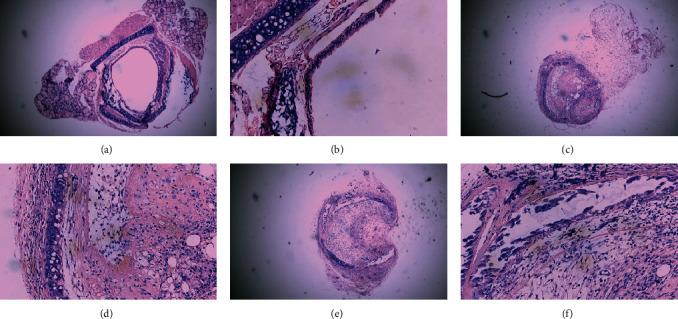 https://cdn.ncbi.nlm.nih.gov/pmc/blobs/c6f7/8337162/4af34640d189/DM2021-5586312.002.jpg