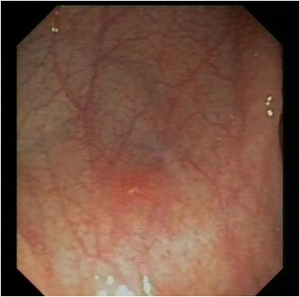 https://cdn.ncbi.nlm.nih.gov/pmc/blobs/c6f9/4097086/ac92799d048f/1471-2431-14-156-2.jpg