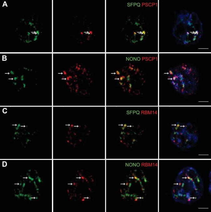 https://cdn.ncbi.nlm.nih.gov/pmc/blobs/c6fa/4987140/cd2e9879fa43/elife-14837-fig1.jpg