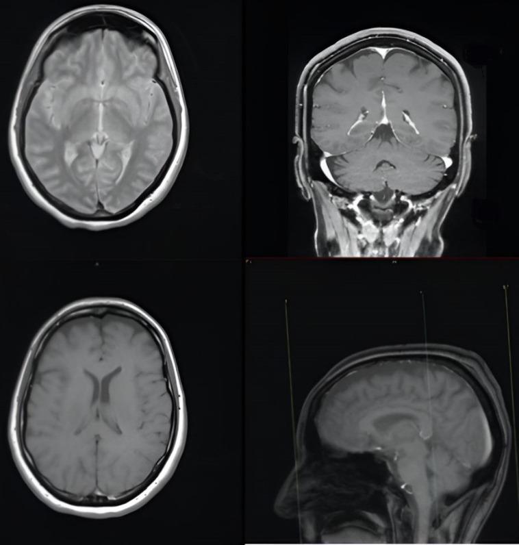 https://cdn.ncbi.nlm.nih.gov/pmc/blobs/c707/12191030/3651277ffa6e/brainsci-15-00628-g001.jpg