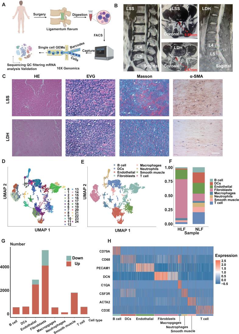https://cdn.ncbi.nlm.nih.gov/pmc/blobs/c71f/12119296/40137afb34ea/fimmu-16-1569296-g001.jpg