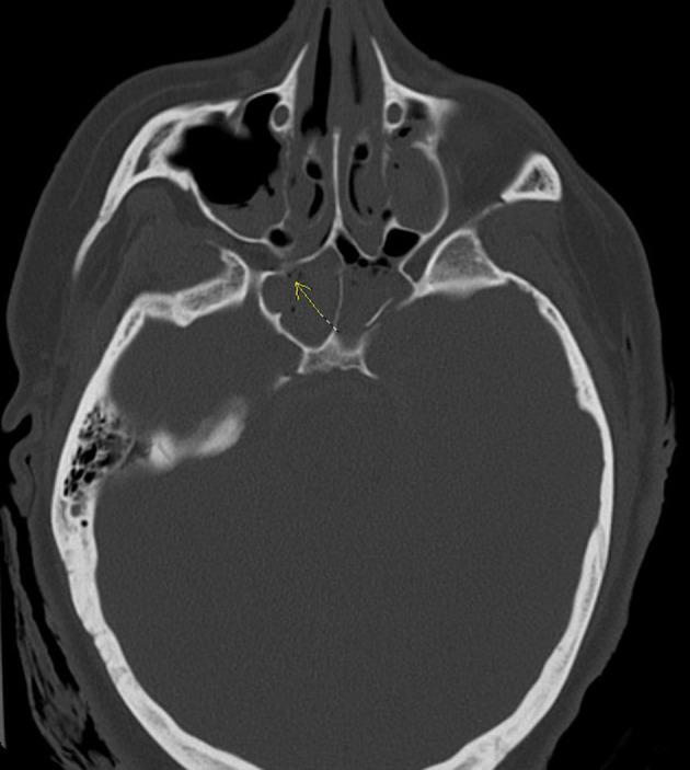 https://cdn.ncbi.nlm.nih.gov/pmc/blobs/c721/11041977/00b8c3025516/OAEM-16-75-g0007.jpg