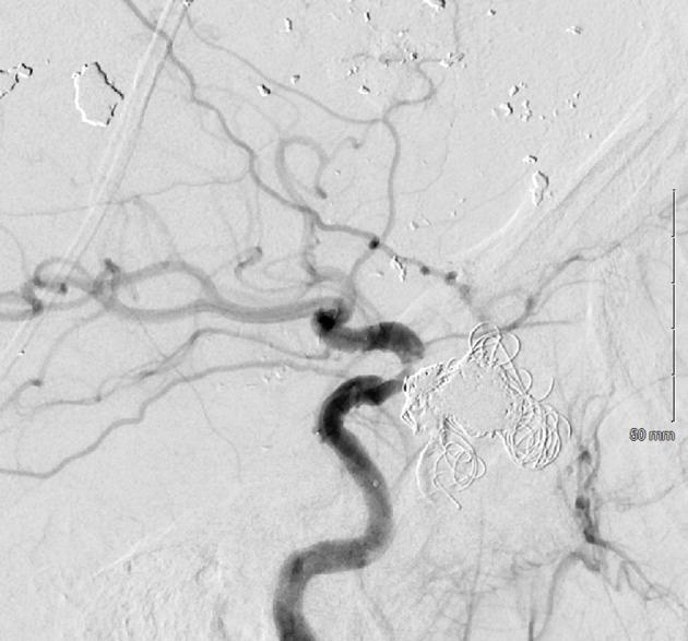 https://cdn.ncbi.nlm.nih.gov/pmc/blobs/c721/11041977/3da0a9edfc48/OAEM-16-75-g0013.jpg