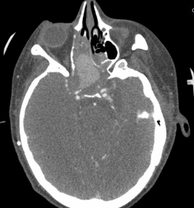 https://cdn.ncbi.nlm.nih.gov/pmc/blobs/c721/11041977/3ed50c7f54b7/OAEM-16-75-g0010.jpg