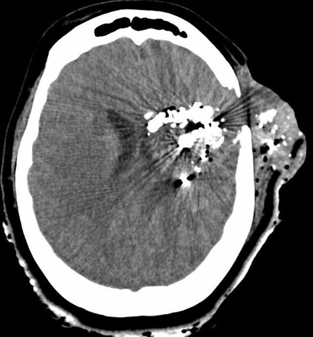 https://cdn.ncbi.nlm.nih.gov/pmc/blobs/c721/11041977/431c54a07750/OAEM-16-75-g0003.jpg