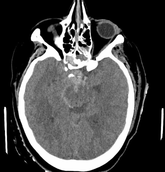 https://cdn.ncbi.nlm.nih.gov/pmc/blobs/c721/11041977/c6dc7b682eb9/OAEM-16-75-g0004.jpg