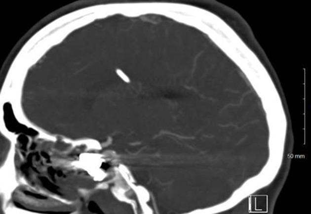 https://cdn.ncbi.nlm.nih.gov/pmc/blobs/c721/11041977/f9e3b3bcce97/OAEM-16-75-g0014.jpg