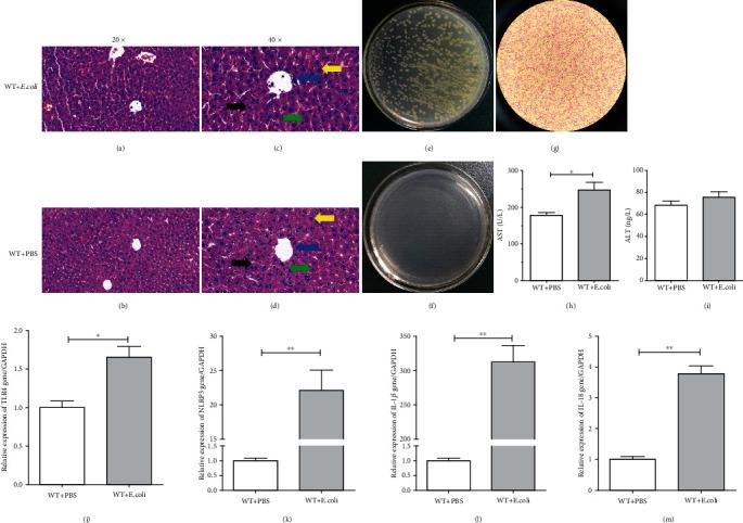 https://cdn.ncbi.nlm.nih.gov/pmc/blobs/c723/8026301/d5618346fcd1/JIR2021-6687555.001.jpg