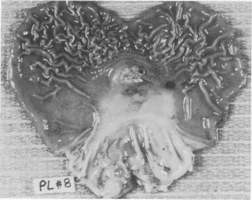https://cdn.ncbi.nlm.nih.gov/pmc/blobs/c724/1345191/81ef85174663/annsurg00209-0044-a.jpg