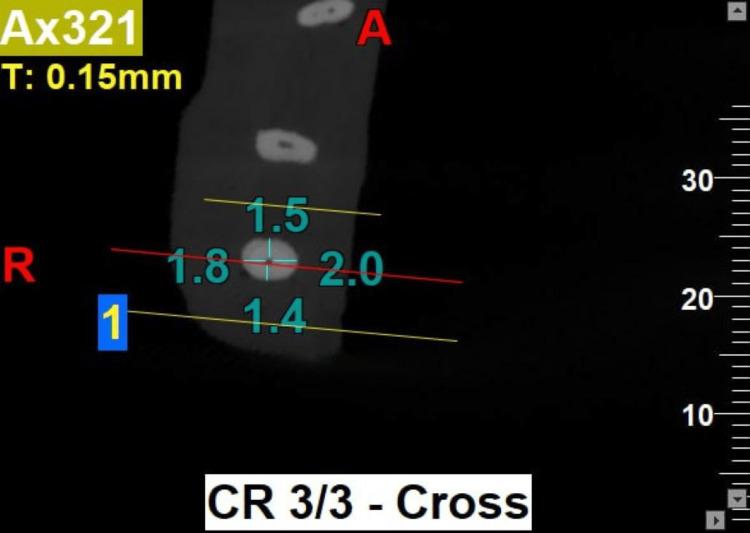 https://cdn.ncbi.nlm.nih.gov/pmc/blobs/c725/11548990/8d8f25934b09/cureus-0016-00000071117-i02.jpg