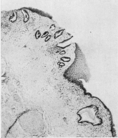 https://cdn.ncbi.nlm.nih.gov/pmc/blobs/c725/474031/47f7aaadc0c5/jclinpath00379-0073-b.jpg