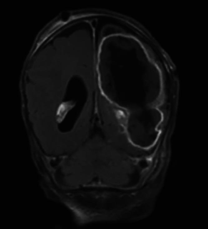 https://cdn.ncbi.nlm.nih.gov/pmc/blobs/c727/10550530/d39a1d4da030/CASE23140f3.jpg