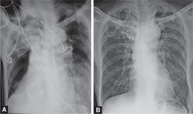https://cdn.ncbi.nlm.nih.gov/pmc/blobs/c72e/7874292/0782a708f0c9/ijccm-25-94-g002.jpg