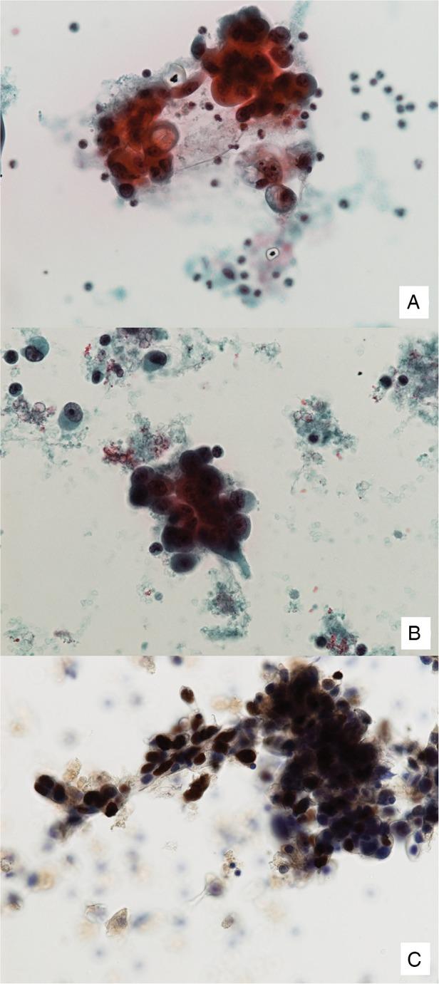 https://cdn.ncbi.nlm.nih.gov/pmc/blobs/c730/4488608/774598ba40ac/bmjresp2014000075f02.jpg