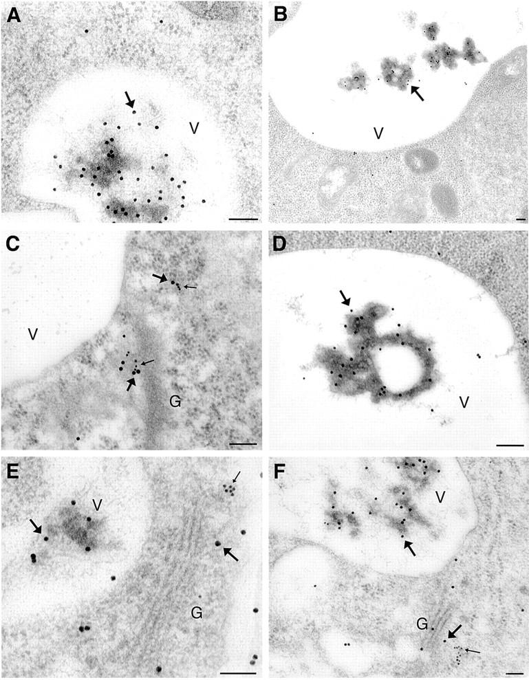 https://cdn.ncbi.nlm.nih.gov/pmc/blobs/c732/2175142/f4c4a3f66803/JCB0004031.f3.jpg
