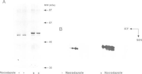https://cdn.ncbi.nlm.nih.gov/pmc/blobs/c732/413415/ec7e46d540ef/emboj00077-0208-b.jpg