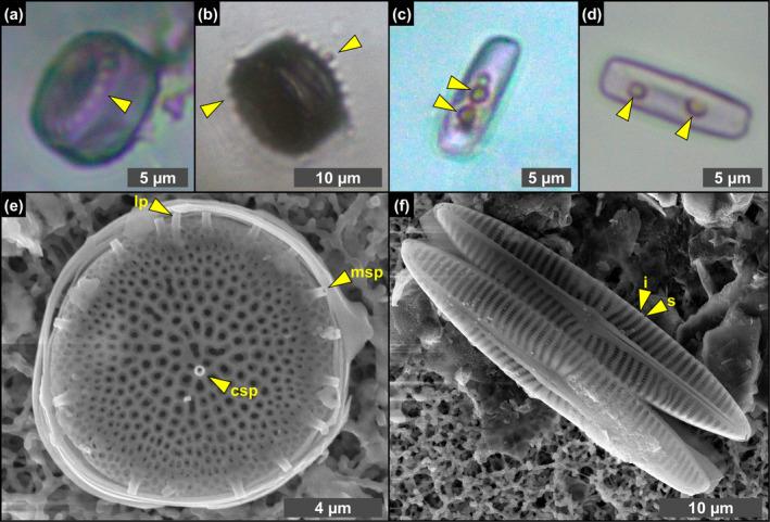 https://cdn.ncbi.nlm.nih.gov/pmc/blobs/c739/11629073/1b3f04c6a607/GBI-22-e70007-g002.jpg