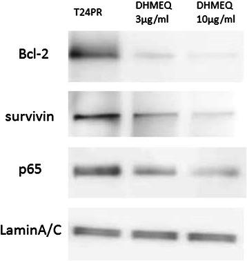https://cdn.ncbi.nlm.nih.gov/pmc/blobs/c741/4424446/bc691ad830bc/12885_2015_1315_Fig6_HTML.jpg