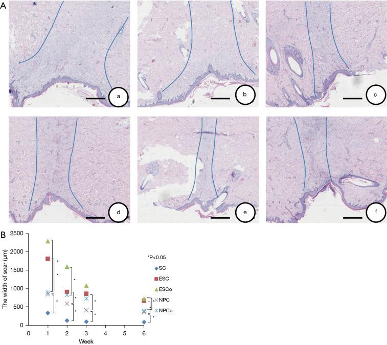 https://cdn.ncbi.nlm.nih.gov/pmc/blobs/c742/8576679/60aa9d8c71f5/atm-09-20-1514-f3.jpg