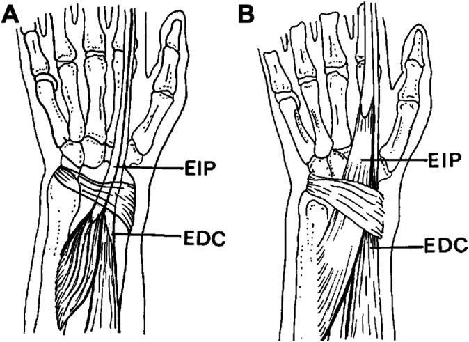 https://cdn.ncbi.nlm.nih.gov/pmc/blobs/c742/9036339/076c13aa9b79/10.1177_23259671221088610-fig8.jpg
