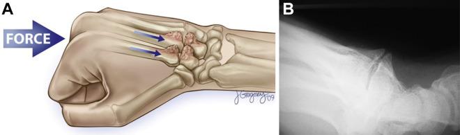 https://cdn.ncbi.nlm.nih.gov/pmc/blobs/c742/9036339/977b79d68c5b/10.1177_23259671221088610-fig2.jpg