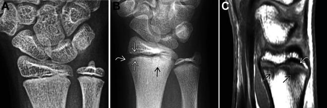 https://cdn.ncbi.nlm.nih.gov/pmc/blobs/c742/9036339/e341deaf294f/10.1177_23259671221088610-fig5.jpg