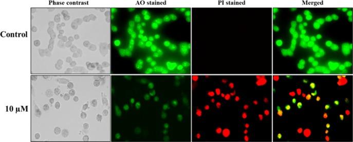 https://cdn.ncbi.nlm.nih.gov/pmc/blobs/c74a/6682138/05637272c500/ao-2019-01022r_0006.jpg
