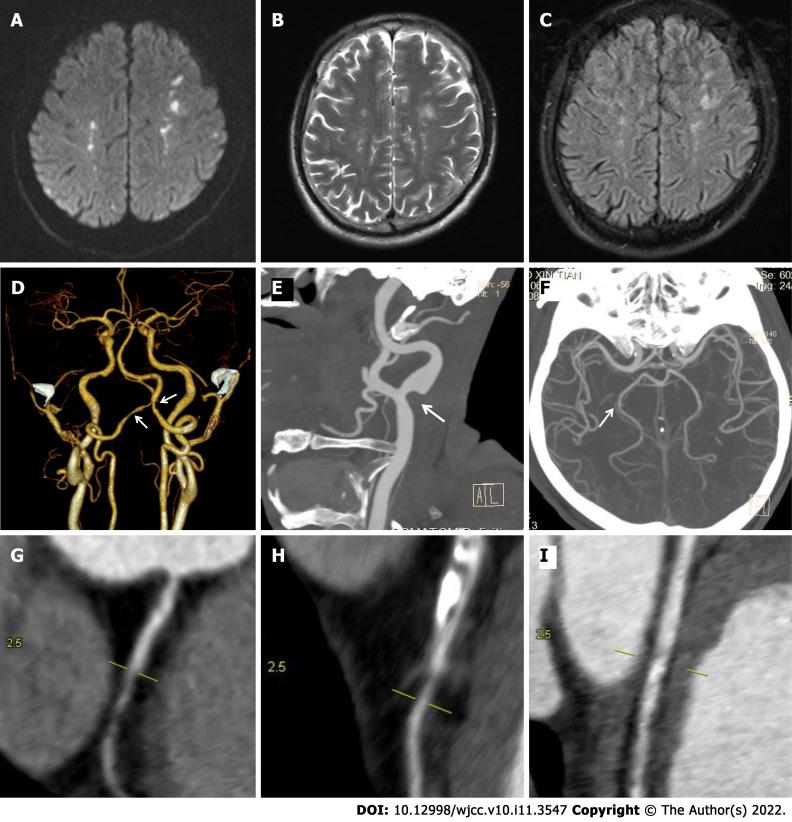 https://cdn.ncbi.nlm.nih.gov/pmc/blobs/c756/9048563/5c6bc8eaf665/WJCC-10-3547-g001.jpg