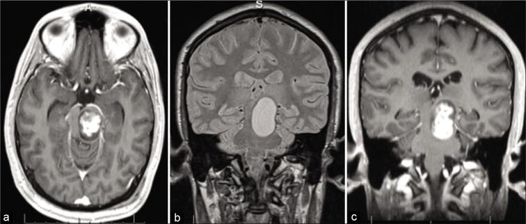 https://cdn.ncbi.nlm.nih.gov/pmc/blobs/c759/7827363/928fbeaef642/SNI-12-12-g001.jpg