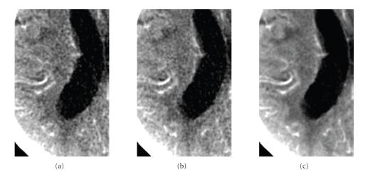 https://cdn.ncbi.nlm.nih.gov/pmc/blobs/c75c/2817390/5b6e67fb697a/IJBI2009-108028.0010.jpg