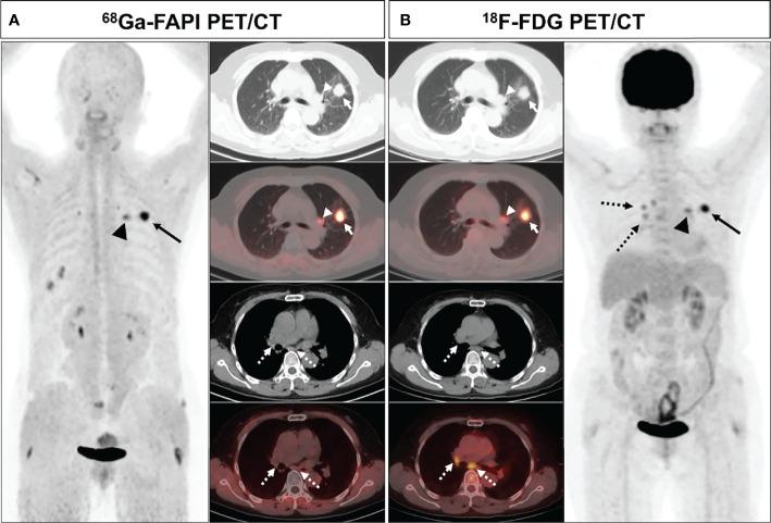 https://cdn.ncbi.nlm.nih.gov/pmc/blobs/c75c/9289292/30437442e150/fonc-12-924223-g006.jpg