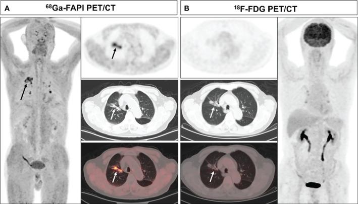 https://cdn.ncbi.nlm.nih.gov/pmc/blobs/c75c/9289292/9da45d12a5f9/fonc-12-924223-g001.jpg