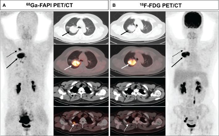 https://cdn.ncbi.nlm.nih.gov/pmc/blobs/c75c/9289292/b99d284f197a/fonc-12-924223-g002.jpg