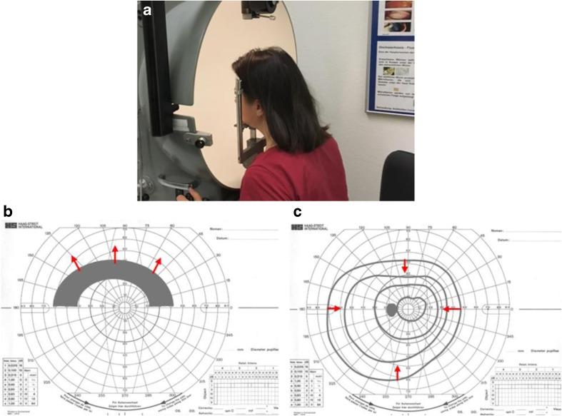 https://cdn.ncbi.nlm.nih.gov/pmc/blobs/c75d/5545999/5aa7e30e9f57/13167_2017_90_Fig1_HTML.jpg