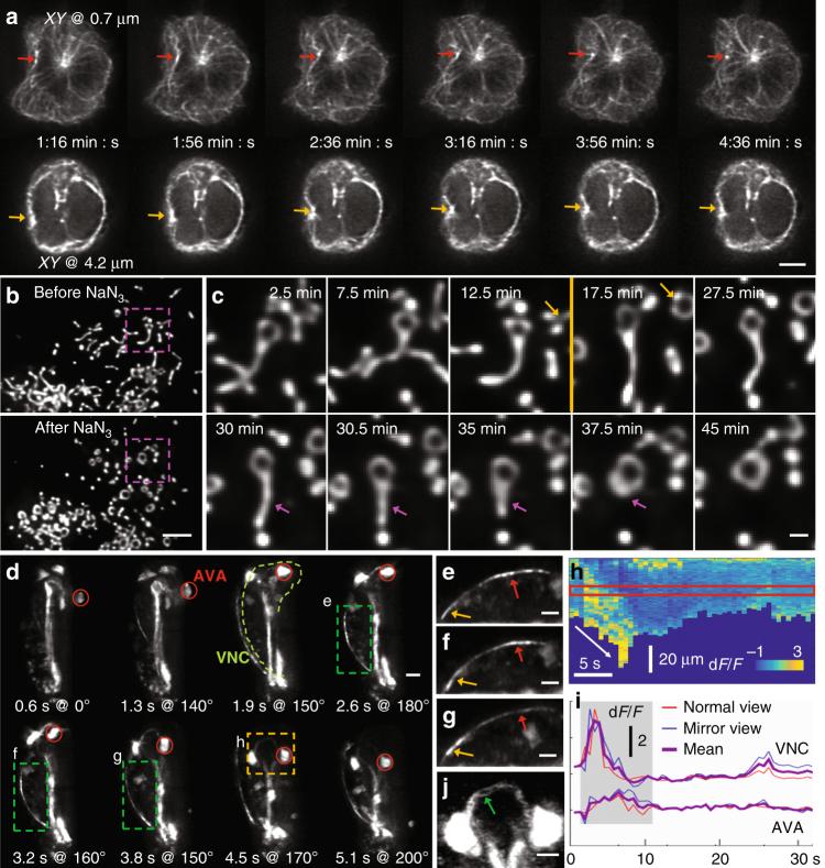 https://cdn.ncbi.nlm.nih.gov/pmc/blobs/c761/5682293/6e6ebcd8c67b/41467_2017_1250_Fig5_HTML.jpg
