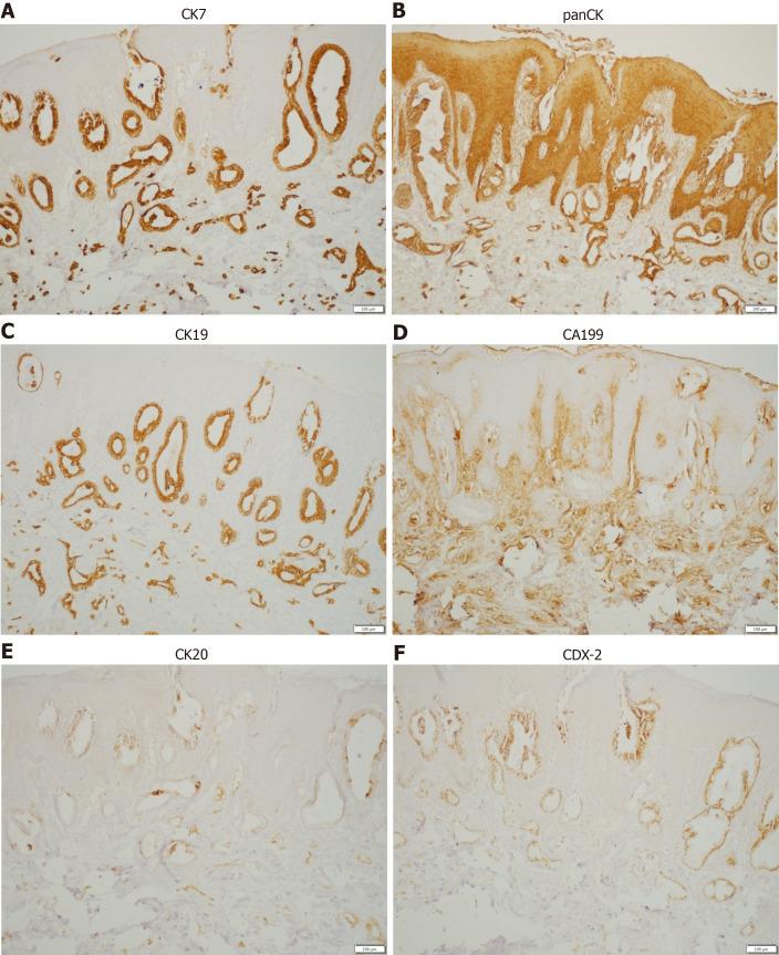 https://cdn.ncbi.nlm.nih.gov/pmc/blobs/c762/7667456/35d5a8881f24/WJGO-12-1372-g004.jpg