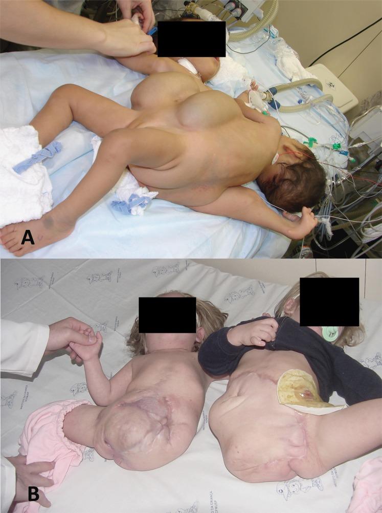 https://cdn.ncbi.nlm.nih.gov/pmc/blobs/c763/3611880/627839114479/cln-68-03-371-g002.jpg