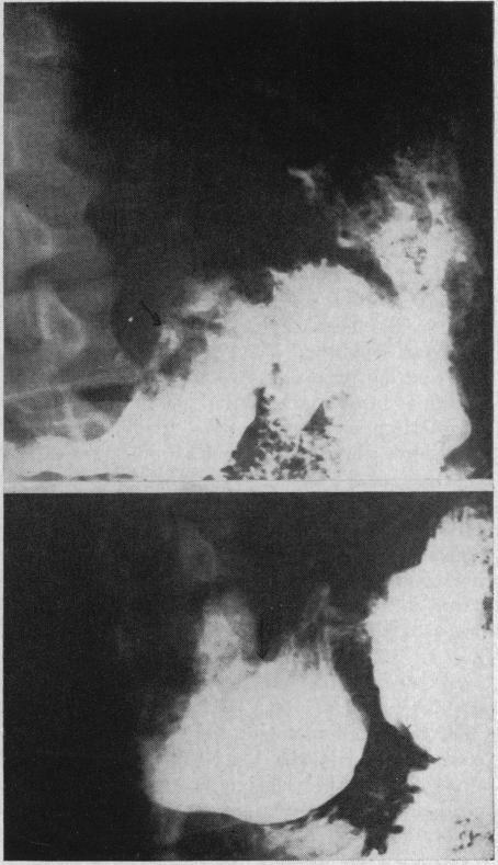 https://cdn.ncbi.nlm.nih.gov/pmc/blobs/c769/1521683/30594faa7341/califmed00212-0037-b.jpg