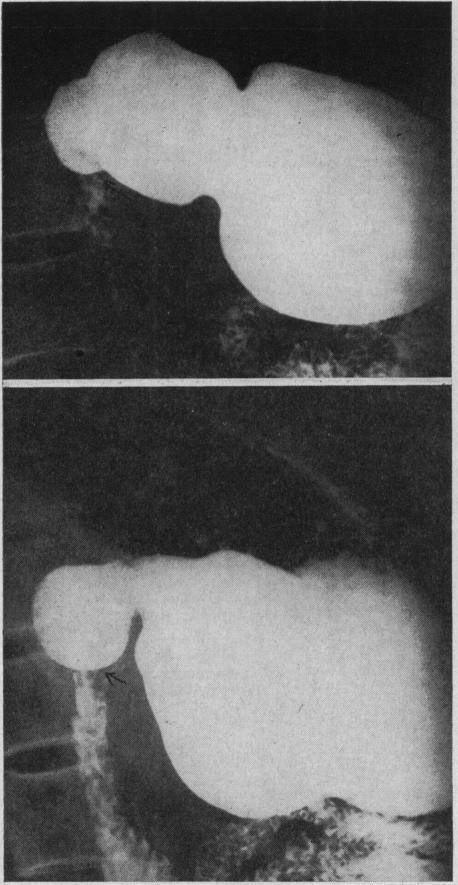 https://cdn.ncbi.nlm.nih.gov/pmc/blobs/c769/1521683/705ba50b496f/califmed00212-0039-a.jpg