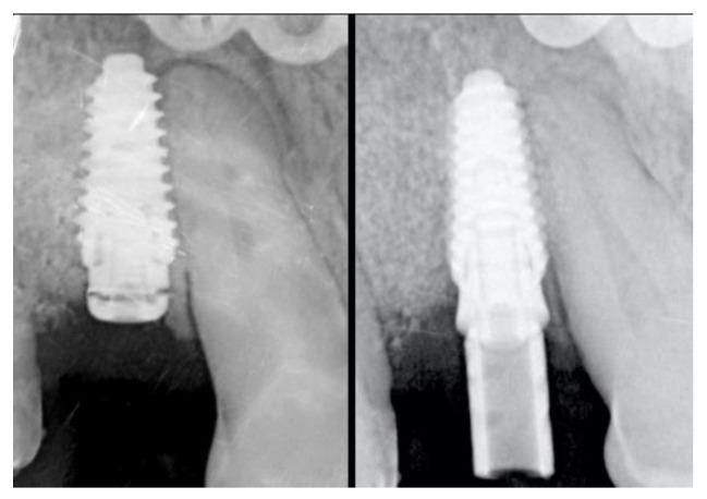 https://cdn.ncbi.nlm.nih.gov/pmc/blobs/c76d/7287986/4fab6dc5ee80/materials-13-02389-g006.jpg