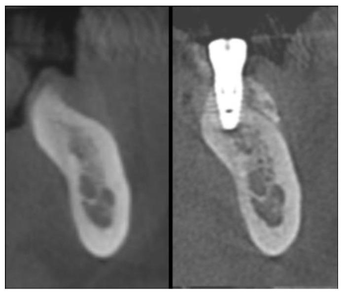 https://cdn.ncbi.nlm.nih.gov/pmc/blobs/c76d/7287986/56868b1663ab/materials-13-02389-g008.jpg